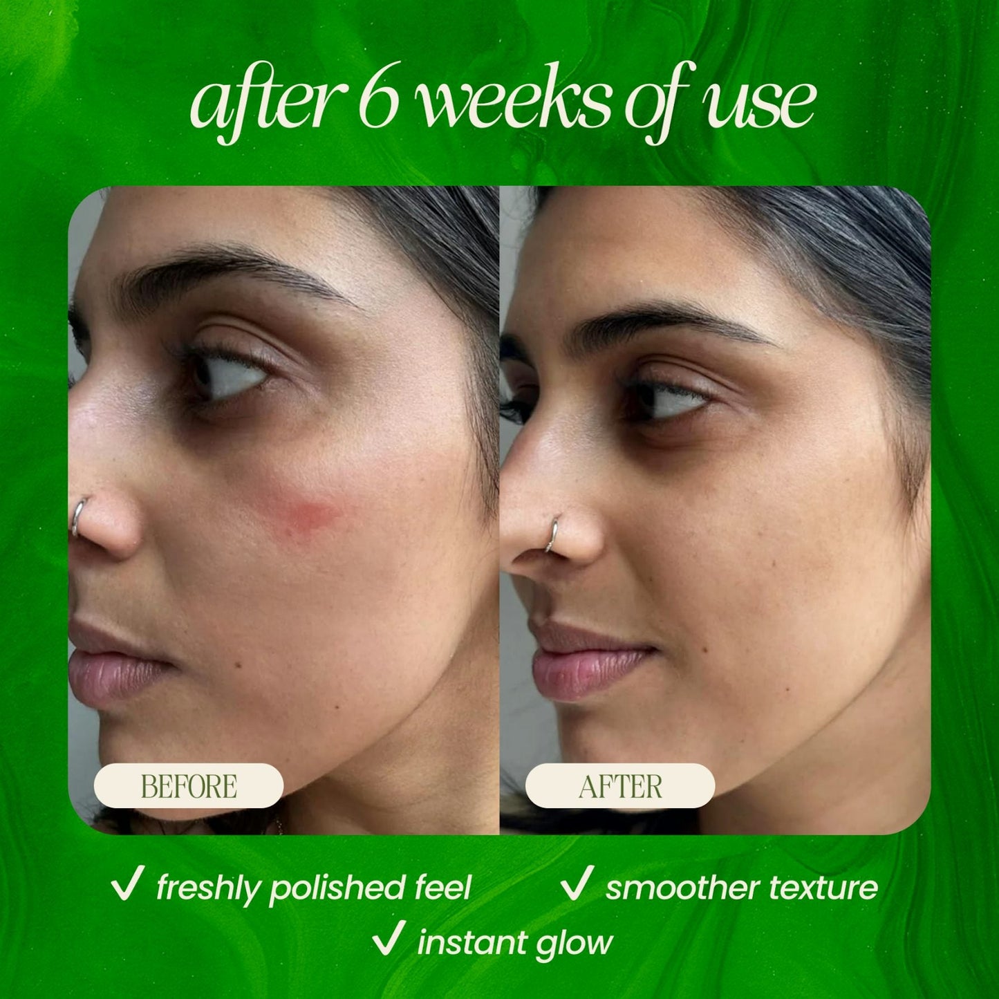 Bamboo Microdermabrasion