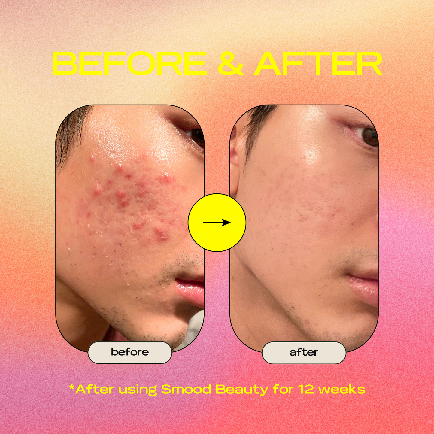 The Smood Experience Kit for Clearer, Calmer Skin